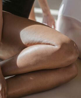 lipoedème pressothérapie {{brizy_dc_image_alt imageSrc=